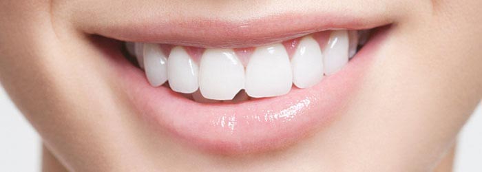 درمان ترک و شکستگی دندان:جلوگیری از تجمع باکتری در دندان شکسته