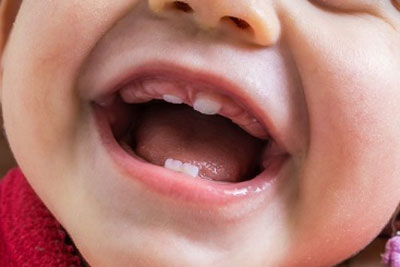 ترتیب دندان درآوردن نوزاد و کودک، مراقبت و مسواک دندان شیری