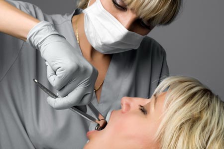 کشیدن دندان (extract) و جراحی: مراقبت بعد، برای جلوگیری از خونریزی