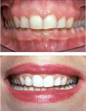 بهترین دندانپزشک زیبایی تهران:لبخند درخشان با متخصص زیبایی دندان