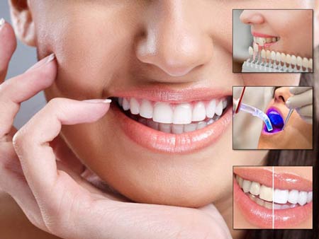 درمان دندان قروچه (براکسیسم) و ساییدن دندان با کاهش استرس و گارد