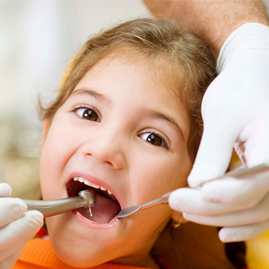 عصب کشی دندان شیری کودکان برای درمان ریشه و پالپ زنده و غیر زنده