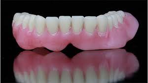 دندان مصنوعی (کامل و تکه ای):پروتز ثابت و متحرک در افراد بی دندان
