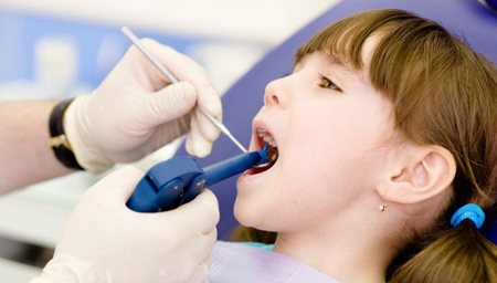 پر کردن دندان کودکان و لزوم ترمیم دندان‌ شیری اطفال