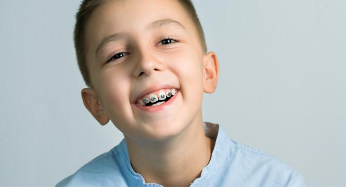 ارتودنسی پیشگیری یا زودهنگام بهترین راه برای رفع نامرتبی دندان کودکان