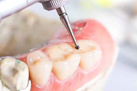 تسکین دندان درد مزمن و ضربان دار با درمان های دندانپزشکی نوین