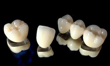 پوسیدگی و خرابی دندان: نقش کاهش اسیدیته دهان در کرم خوردگی دندان