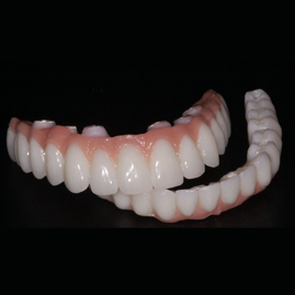 درمان بی دندانی کامل با کاشت ایمپلنت تمام فک بر پایه 4 ایمپلنت (all on 4)