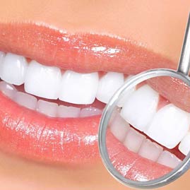 مزیت های پرسلین ونیر نسبت به سایر روش های زیبایی دندان